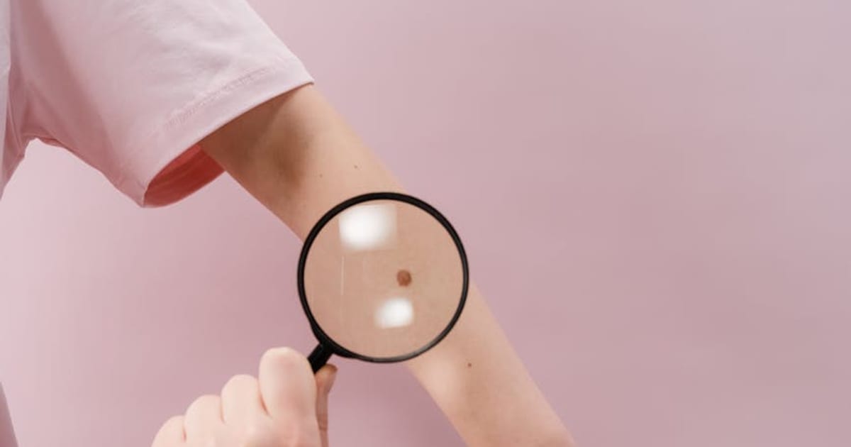 Dermatologist examining a patient's skin, representing skin cancer screening frequency guidelines for adults